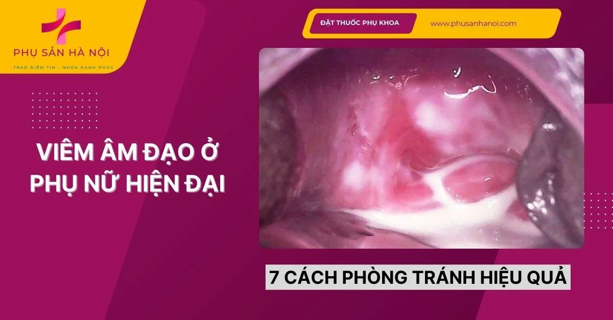 7 Cách Phòng Tránh Viêm Âm Đạo Hiệu Quả Cho Phụ Nữ Hiện Đại 7 Cách Phòng Tránh Viêm Âm Đạo Hiệu Quả