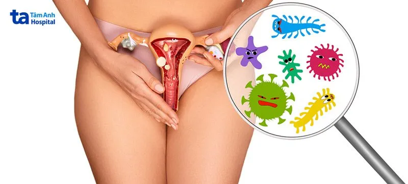 7 Cách Phòng Tránh Viêm Âm Đạo Hiệu Quả Cho Phụ Nữ Hiện Đại