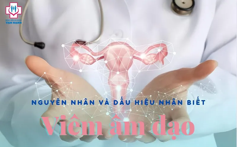 7 Cách Phòng Tránh Viêm Âm Đạo Hiệu Quả Cho Phụ Nữ Hiện Đại 7 Cách Phòng Tránh Viêm Âm Đạo Hiệu Quả Cho Phụ Nữ Hiện Đại