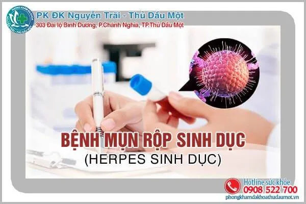5 Phương pháp chữa và phòng ngừa mụn rộp sinh dục hiệu quả tại Phụ sản Hà Nội