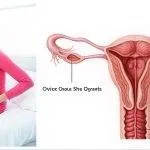 U nang buồng trứng khi mang thai